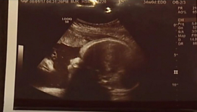 Jesus watches over baby in the womb in amazing sonogram photo