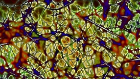 Parkinson's disease news 2018: Excess calcium in brain leads to Parkinson's, scientists say