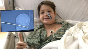 Miracle after 10-year-old son survives being impaled by meat skewer