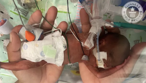 World\'s most premature baby was born 3 weeks before UK abortion limit