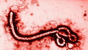 Ebola airborne? Ways of transmission and how to protect yourself