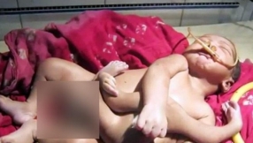 Crowds flock to see baby born with 8 limbs named \'God Boy\' by his parents