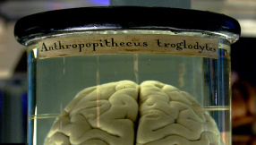 Around 100 brains go missing from the University of Texas