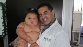 Doctors investigate baby\'s mysterious 38-lb. weight gain