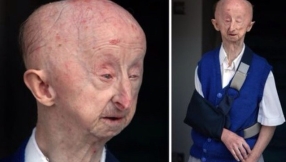 Over Â£200,000 in donations raised for disabled pensioner mugged outside his home