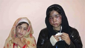 3 Afghan girls splashed with acid on their faces \'as punishment for going to school