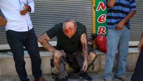 Turkey: Suspected ISIS suicide bombing kills at least 27