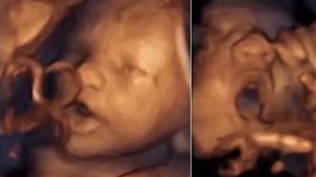 Unborn babies can already \'sing\' as early as  16 weeks in their mother\'s womb â study