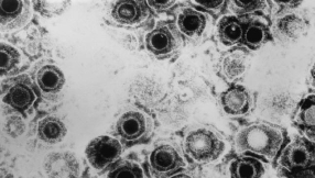 Over 3.7 billion people â two-thirds of  world\'s population â infected by herpes virus, WHO reveals