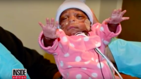 \'Miracle baby girl\' E\'Layah Faith Pegues beats the odds as parents keep their faith