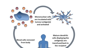 \'Unprecedented\': New treatment using modified cells cures cancer patients, even those in advanced stage