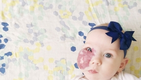 Christian mom doesn\'t want people to pray for her young daughter with facial tumour, citing this reason