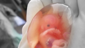 Mother sues doctor over botched abortion that left her unable to have children for life