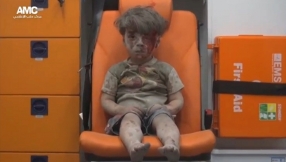 Brother of Syrian boy pictured in Aleppo dies of his wounds